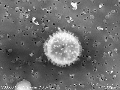 PM2.5中の微生物類（10,000倍）