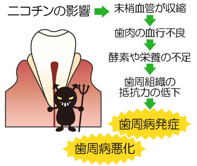 図解:ニコチンが歯周病に及ぼす影響