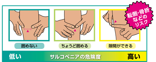 囲めない、ちょうど囲める、隙間ができる(転倒・骨折などのリスク)