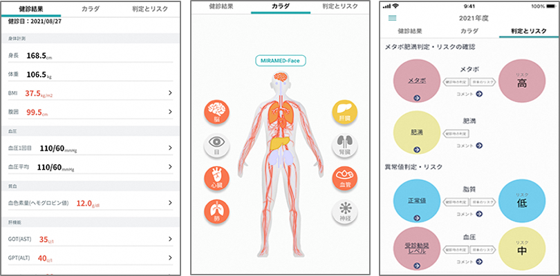 MIRAMED健康状態の見える化